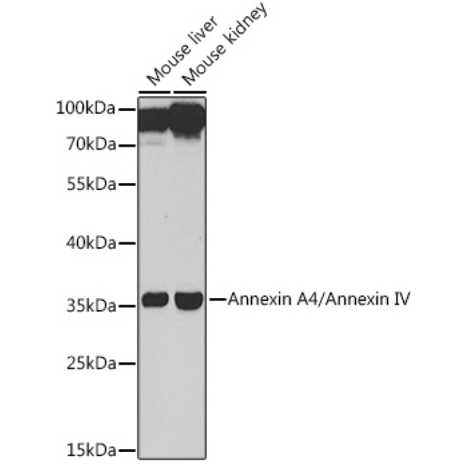 Annexin A4/Annexin IV Rabbit Polyclonal Antibody