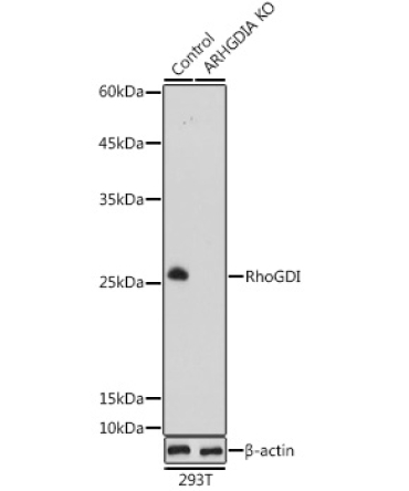 RhoGDI Rabbit Polyclonal Antibody [KO Validated]