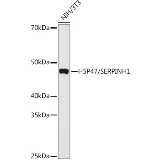 HSP47/SERPINH1 Rabbit Polyclonal Antibody