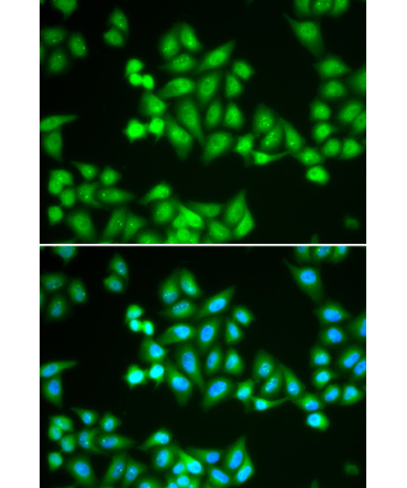 CHD2 Rabbit Polyclonal Antibody