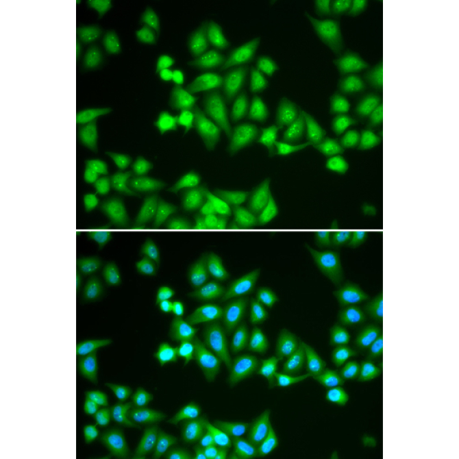 CHD2 Rabbit Polyclonal Antibody