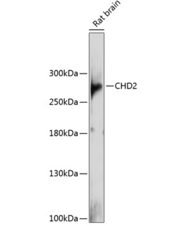 CHD2 Rabbit Polyclonal Antibody