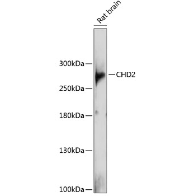 CHD2 Rabbit Polyclonal Antibody