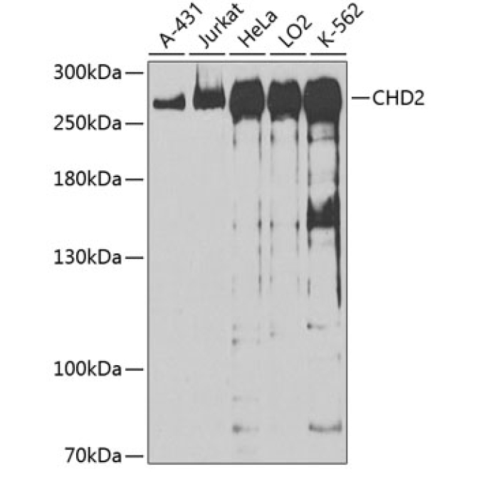 CHD2 Rabbit Polyclonal Antibody