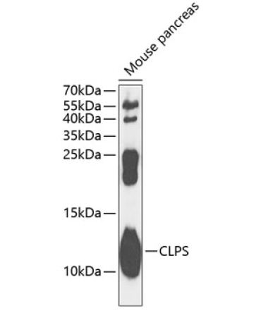 CLPS Rabbit Polyclonal Antibody