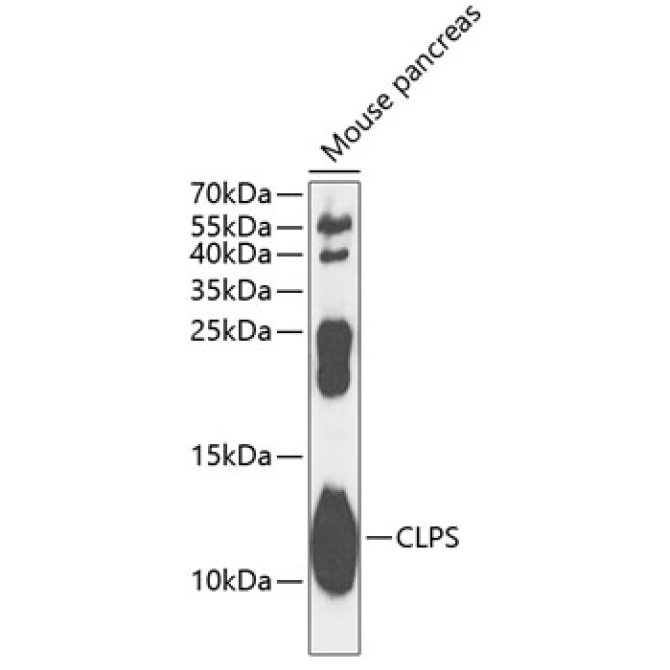 CLPS Rabbit Polyclonal Antibody