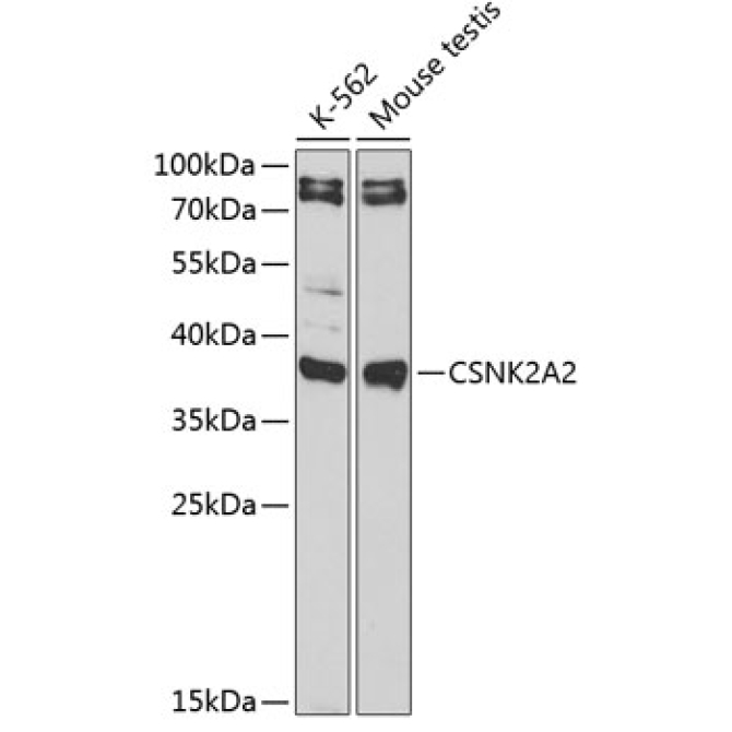 CSNK2A2 Rabbit Polyclonal Antibody