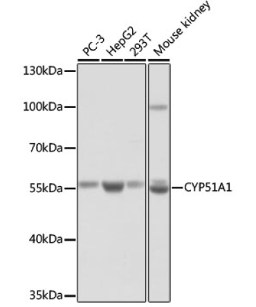 CYP51A1 Rabbit Polyclonal Antibody