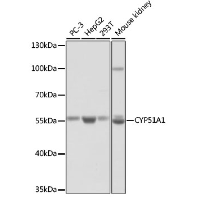 CYP51A1 Rabbit Polyclonal Antibody