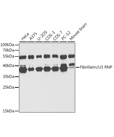Fibrillarin/U3 RNP Rabbit Polyclonal Antibody