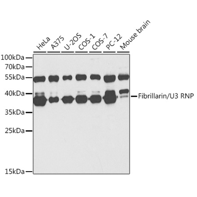 Fibrillarin/U3 RNP Rabbit Polyclonal Antibody