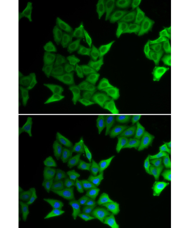 GJA5 Rabbit Polyclonal Antibody