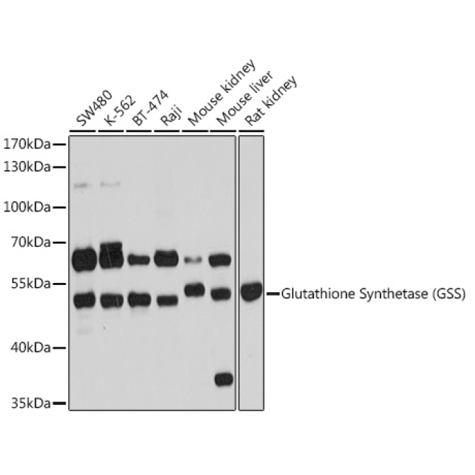 Glutathione Synthetase (GSS) Rabbit Polyclonal Antibody