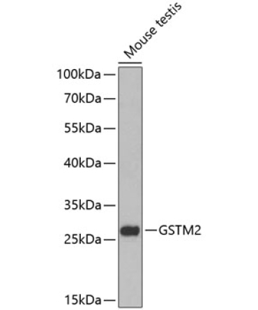 GSTM2 Rabbit Polyclonal Antibody