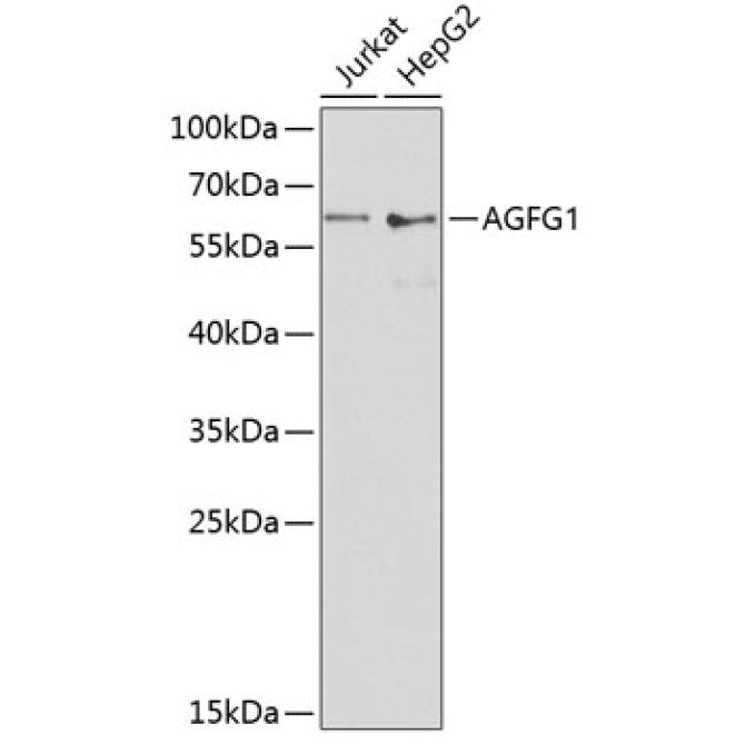 AGFG1 Rabbit Polyclonal Antibody