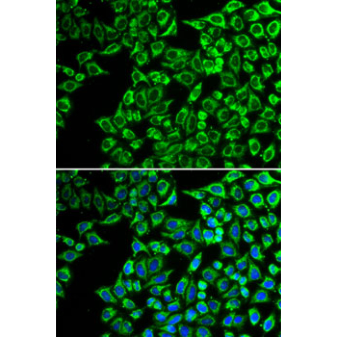 LIPC Rabbit Polyclonal Antibody