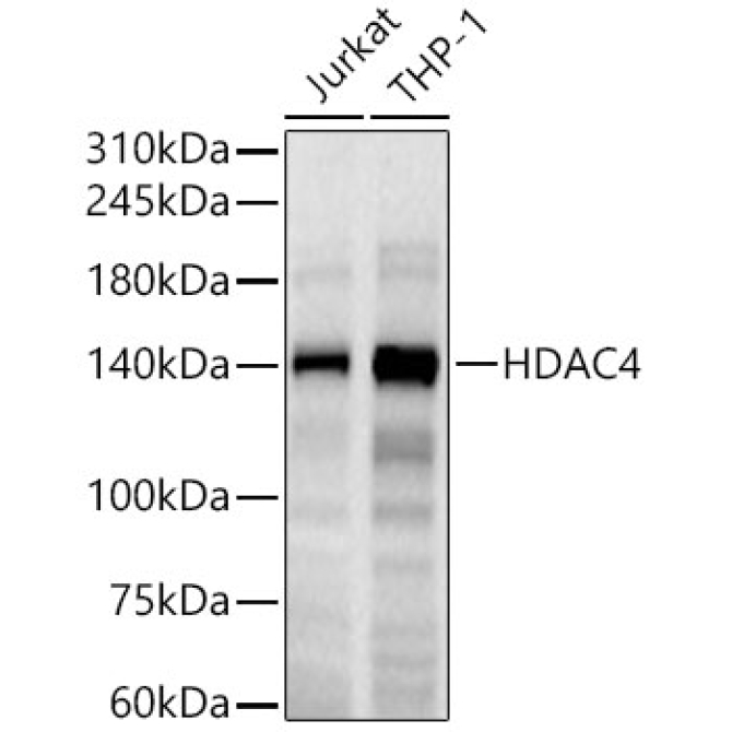 HDAC4 Rabbit Monoclonal Antibody