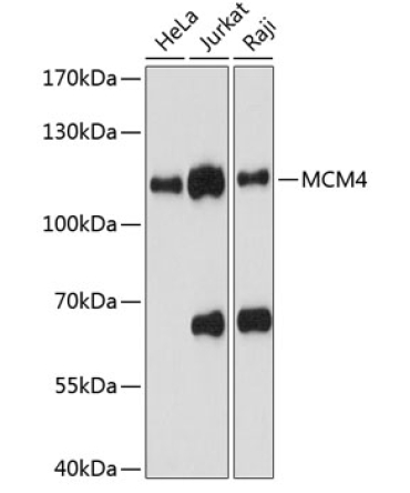 MCM4 Rabbit Polyclonal Antibody
