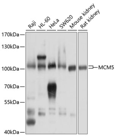 MCM5 Rabbit Polyclonal Antibody