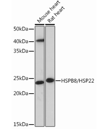 HSPB8/HSP22 Rabbit Monoclonal Antibody