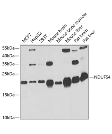 NDUFS4 Rabbit Polyclonal Antibody