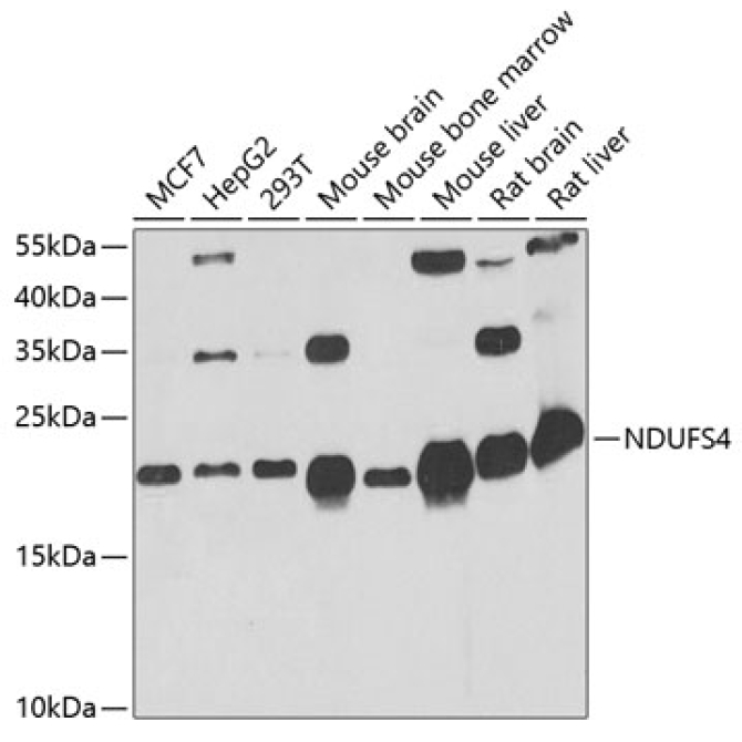 NDUFS4 Rabbit Polyclonal Antibody