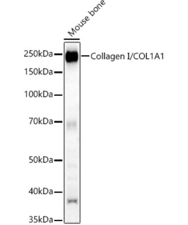 Collagen I/COL1A1 Rabbit Polyclonal Antibody