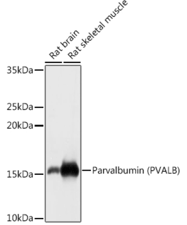 Parvalbumin/PVALB Rabbit Polyclonal Antibody