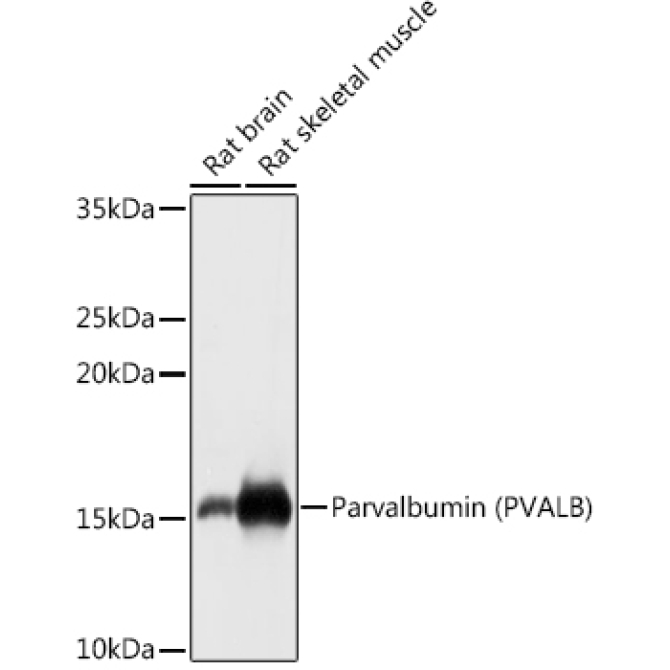 Parvalbumin/PVALB Rabbit Polyclonal Antibody