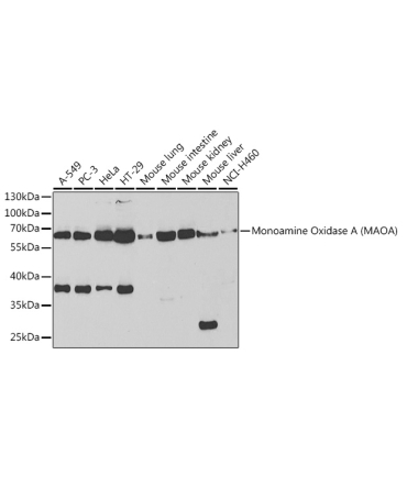 Monoamine Oxidase A (MAOA) Rabbit Polyclonal Antibody