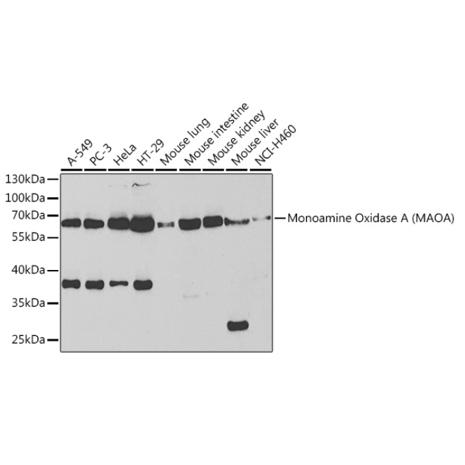 Monoamine Oxidase A (MAOA) Rabbit Polyclonal Antibody