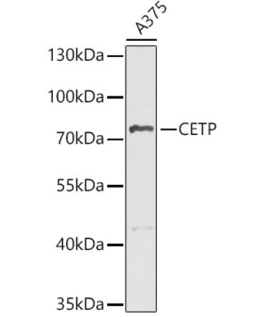 CETP Rabbit Polyclonal Antibody