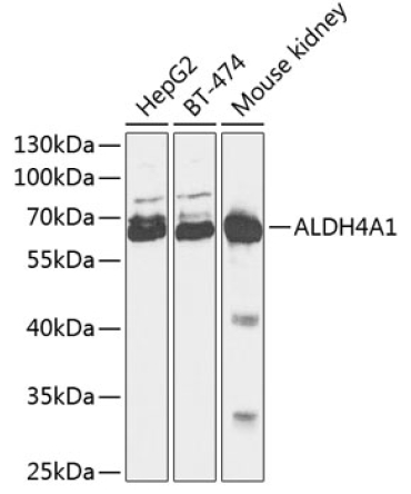 ALDH4A1 Rabbit Polyclonal Antibody