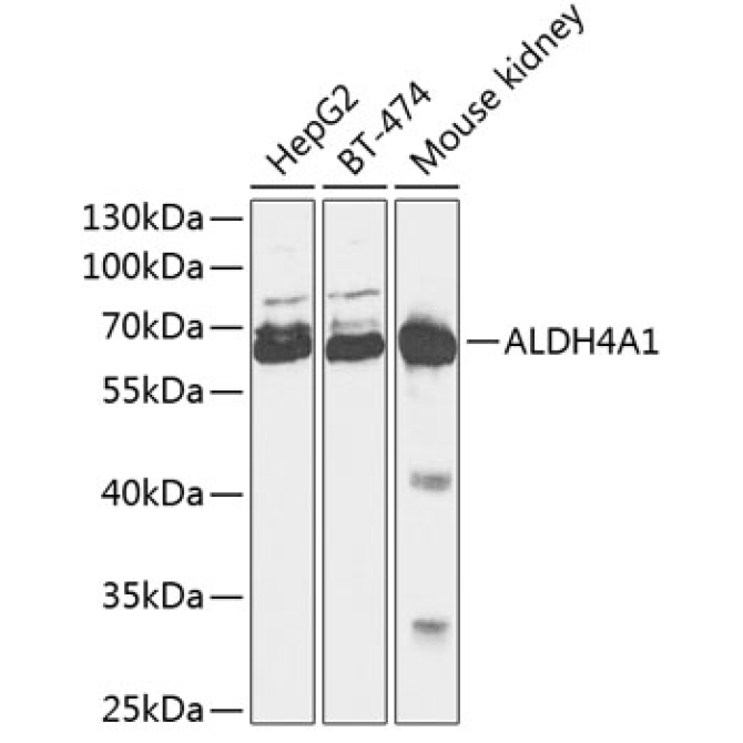 ALDH4A1 Rabbit Polyclonal Antibody