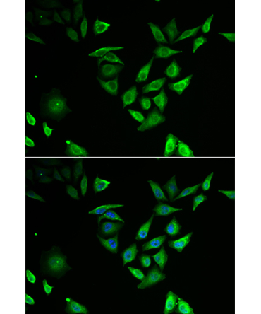 NUTF2 Rabbit Polyclonal Antibody