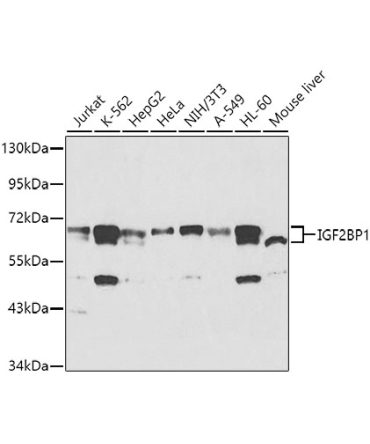 IGF2BP1/IMP1 Rabbit Polyclonal Antibody