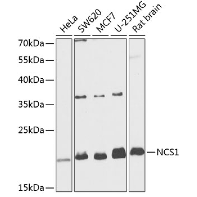 NCS1 Rabbit Polyclonal Antibody