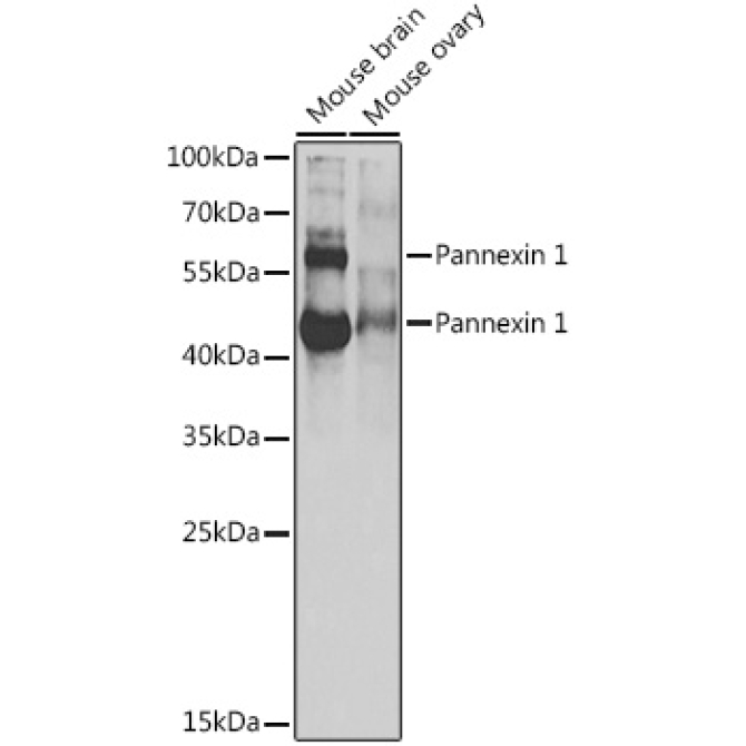 Pannexin 1 Rabbit Polyclonal Antibody