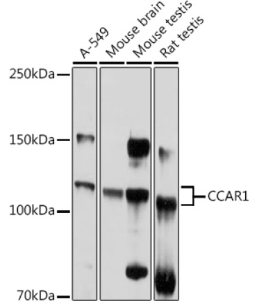 CCAR1 Rabbit Polyclonal Antibody