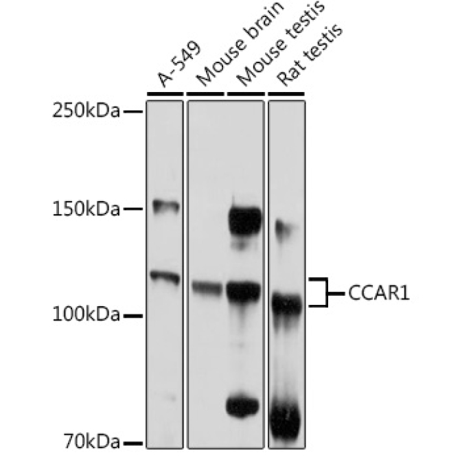 CCAR1 Rabbit Polyclonal Antibody