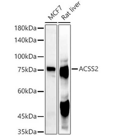 ACSS2 Rabbit Polyclonal Antibody