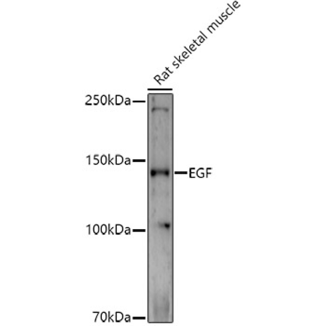 EGF Rabbit Polyclonal Antibody