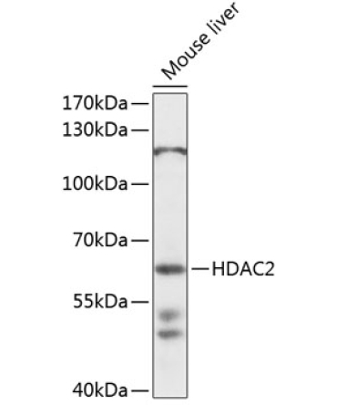 HDAC2 Rabbit Polyclonal Antibody