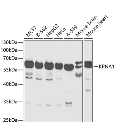 KPNA1 Rabbit Polyclonal Antibody