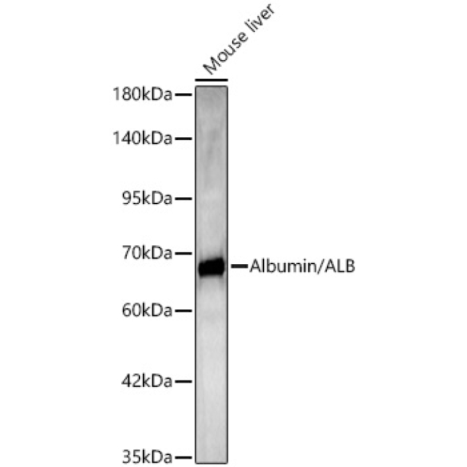 Albumin Rabbit Polyclonal Antibody