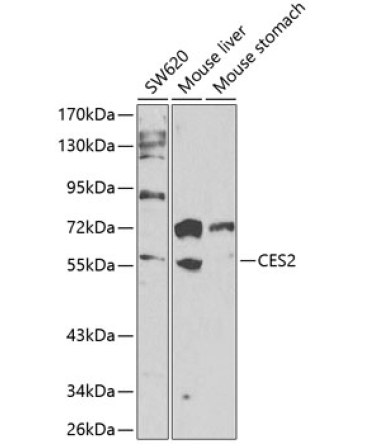 CES2 Rabbit Polyclonal Antibody