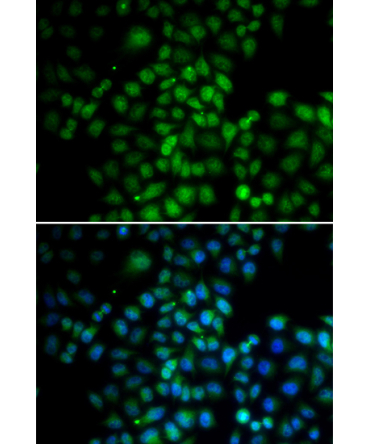 C11orf30 Rabbit Polyclonal Antibody