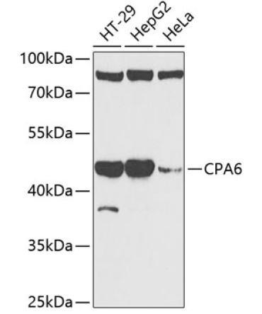 CPA6 Rabbit Polyclonal Antibody