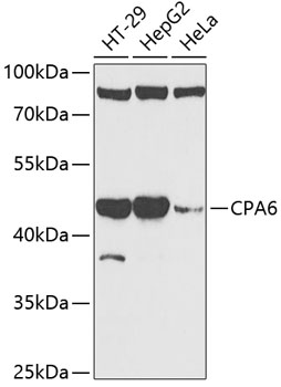 CPA6 Rabbit Polyclonal Antibody