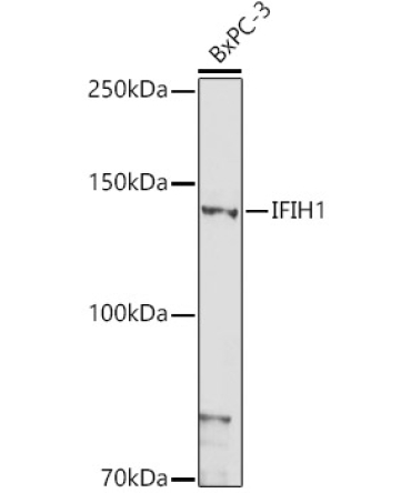 IFIH1 Rabbit Polyclonal Antibody